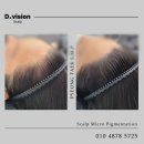 디비전 스칼프 이미지