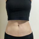 [일원1] 나의 피부를 설계하다 (6주: 3/4~4/8) | 천호 다이어트 복부 무한람스 6주차! 운동 없이 리얼 찐후기(전후 사진 보정 없음)