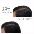 영앤유 | 부천두피문신 맛집 영앤유, 후기가 증명하는 곳!