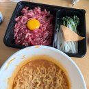 흑석임치과의원 | 신촌 사랑니 맛집🦷 라이크치과 매복 사랑니 발치 후기