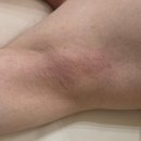 그남자토탈인테리어 | 원주 무실동왁싱 다올뷰티 토탈뷰티샵 남자겨드랑이왁싱 안아프고 깔끔