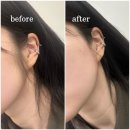 용산-100 | 용산왁싱 재방문의사 100% 유소소왁싱 리얼 후기