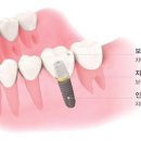 삼성이플러스치과 이미지