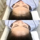 해인헤어라인