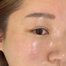 필 | 인천 피부관리 추천 휘온 구월점 트로이필 후기