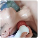 알포유수테라피