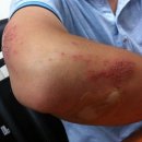 예스본의원 이미지