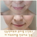 ㈜조이플 | 신논현피부과 큐티셀 스킨부스터 피부트러블 전후 비교 강력추천해요
