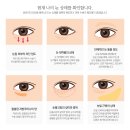 스타준성형외과 네이버블로그