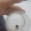 30대 남자친구/담낭(쓸개)절제수술 후기/급성담낭염/입원/비용