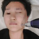 다빈레이저