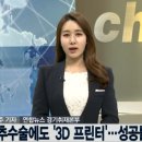 척추 수술에 도입된 3D 프린터 이미지