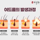 신대피부과