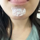 에이치약국 | 입술 헤르페스 먹는 약 추천 헤르메딕스 에이치클로버 영양제 내돈내산 추천 효과 진짜 좋음! 부작용 있음!