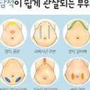 담적이란? 증상 치료 방법 이미지