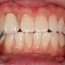 스탠다드치과 이미지