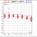 보청기클리닉 이미지
