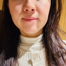 윤슬피부과의원 | 양준상의원 제균치료 후기 / 진균성 모낭염, 주사피부염, SIBO