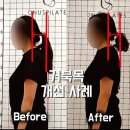 아름동해피라움1앞 | 아름동 필라테스 3000건 체형 변화의 차이