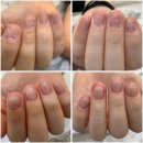 영종도 물어뜯는 손톱 교정, '아이온네일'에서 찾은 역대급 비포애프터! (숨기고 싶은 손톱 안녕 👋)