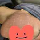 답십리역 피부과 전문 병원 BEST 추천 6곳