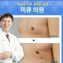 미큐의원 | 강남여유증, 미큐의원의 남자여유증원인 알아보기