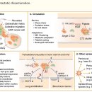 Re: 전이 개시세포, 미세전이(micro-metastasis)와 거시전이(macro-metastasis) 이미지