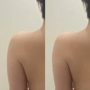 유선1호 | 청주 윤곽관리 ㅣ 청주 바디관리 ㅣ 청주 에스테틱 ㅣ 에스테티아 청주 사창1호점 솔직후기