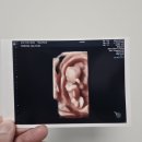 두려울 땐 뒤를 돌아봐 [5월]