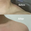 장전로6번길(3-305) | [경기/분당] &#34;메스티“ 체형관리 후기💆‍♀️다이아테라피로✨ 승모근/셀룰라이트 관리 완전 만족!