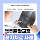 내당동정형외과 틀어진 골반과 척추 정렬 변화, 환자사례로 알아보기
