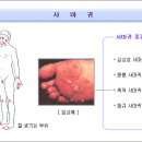 사마귀 이미지