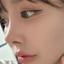 젠뷰 | 낮은 코 짧은 코 성형 2탄 -3개월차 리얼후기
