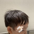 에스원성형외과의원 | 어린이흉터치료 송도안녕성형외과