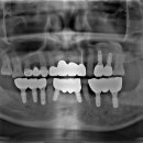 BS치과기공소 이미지