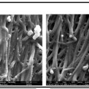 Collagen Piezoelectric effect induce bone healing. 2007년 이미지