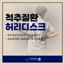 김포시청허리디스크 작은 허리 통증도 방치하면 안되는 이유는? 허리디스크 치료법 이미지