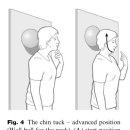 두통과 경추통 예방 및 관리 치료운동 - Chin-in 이미지