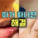 세상에서 가장 강력한 천연항생제! 오레가노 효능 부작용 하루 권장량 이미지