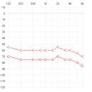 세종보청기 이미지
