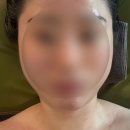 좋은효소수원스타본부 | 결혼준비 수원웨딩관리 클라라피부 붓기관리 리프팅1회차후기