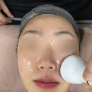 오산 웨딩관리 피부짱 라라필 관리 후기