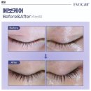 우미K뷰티 네이버블로그