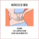 허리디스크 치료 방법 추닥터스에서 확인해보세요 이미지