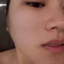 포항시북구71 | 포항 피부관리 추천! 윤s 피부 닥토필 관리 후기