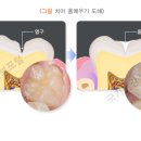 서울인치과의원 이미지