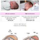 청호약국 | [출산후기] 미즈메디 산부인과 자연분만 &amp; 흡입분만 (담당의 dr.오정미, 분만의 dr.이승용)
