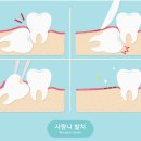 스마일러치과의원 이미지