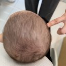 디씨엘진단검사의학과의원 | 4개월 아기 사경 치료 후기｜쑥쑥재활의학과 진료부터 재활 치료까지