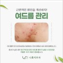 나미피부과의원 네이버블로그